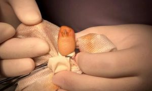 24歲女孩指甲驚現“瑪莎拉蒂”標志縮略圖