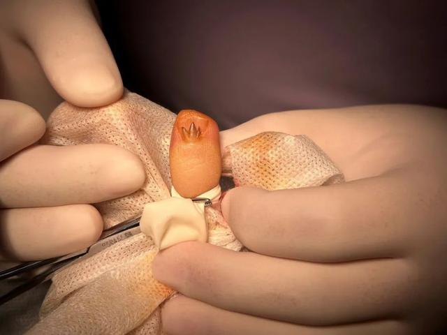 24歲女孩指甲驚現(xiàn)“瑪莎拉蒂”標志插圖