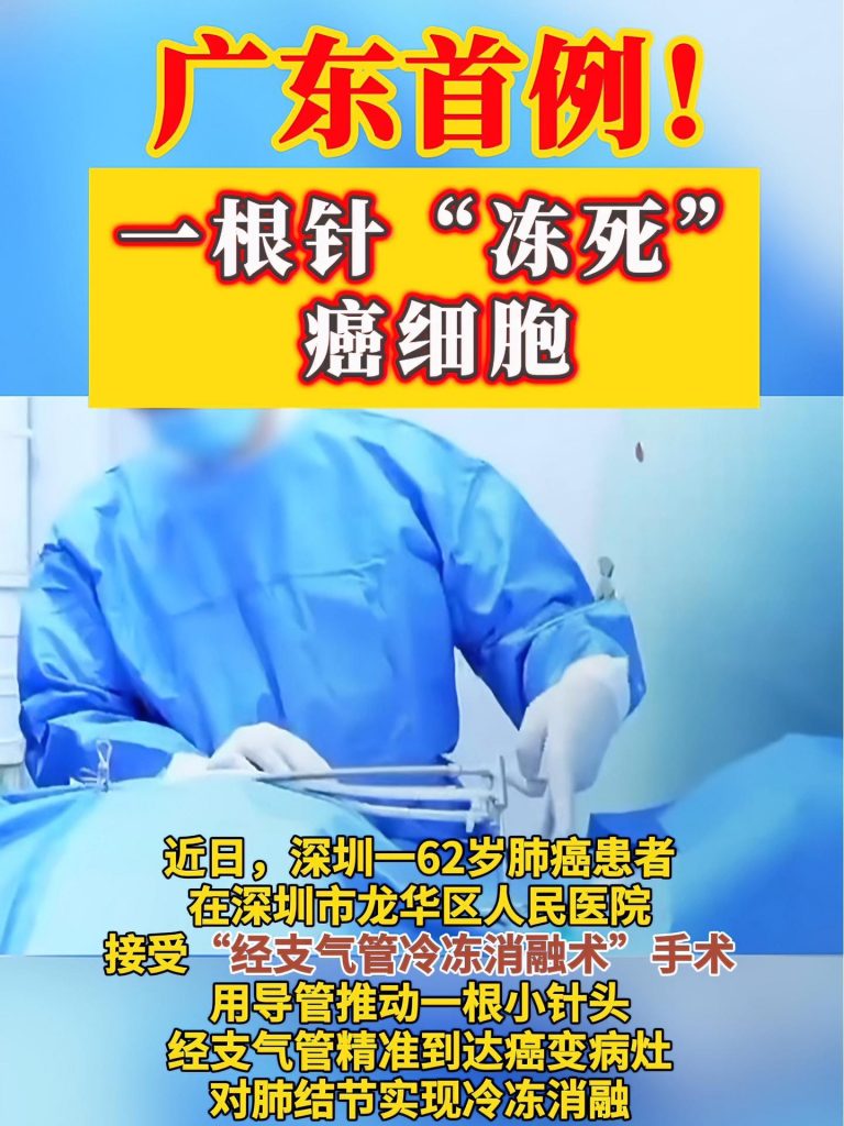 男子確診肺癌醫生一根針凍死癌細胞插圖 男子確診肺癌醫生一根針凍死癌細胞插圖