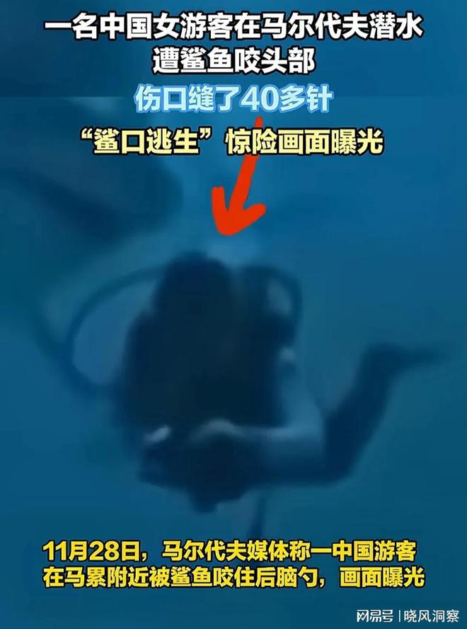 被鯊魚咬傷中國(guó)女游客已回國(guó)插圖 被鯊魚咬傷中國(guó)女游客已回國(guó)插圖